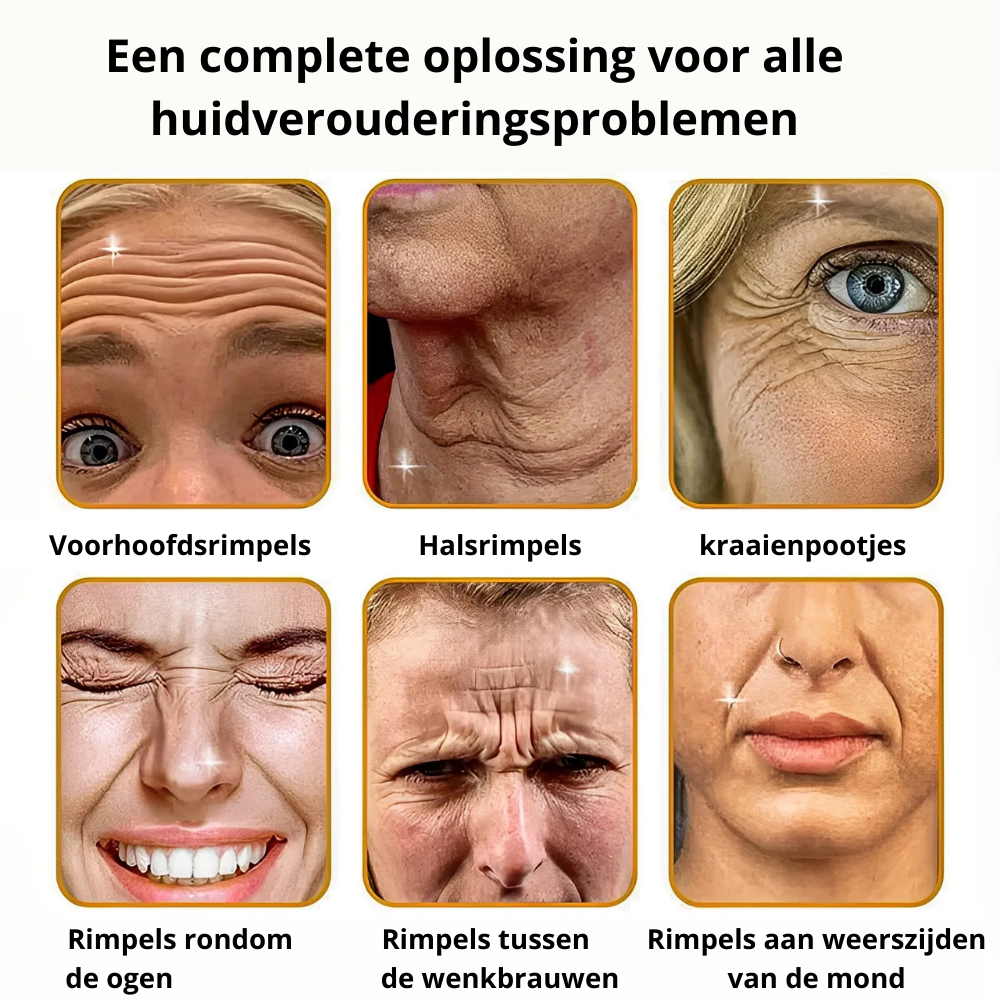 BOTOX