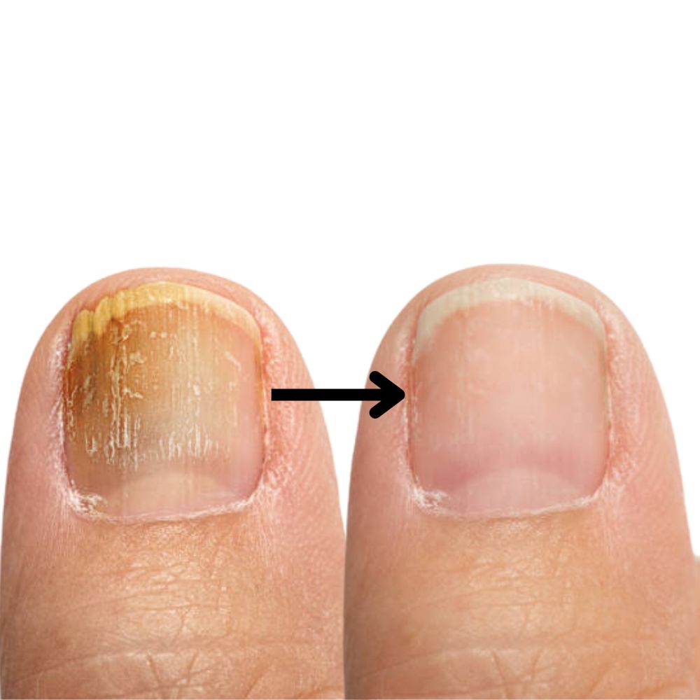 NailPure