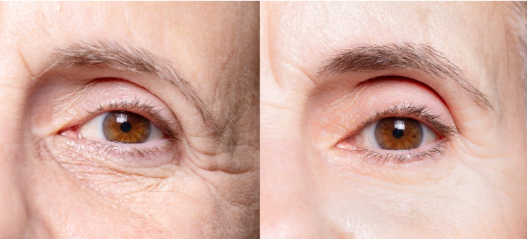 EyeRevive