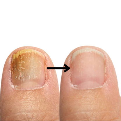 NailPure