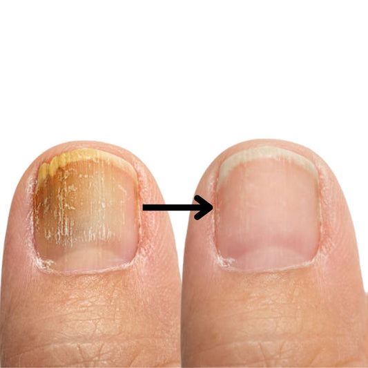 NailPure